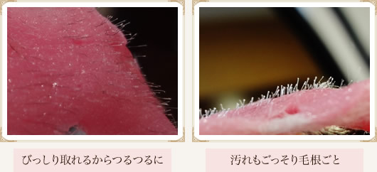 小鼻&口ヒゲWAX脱毛